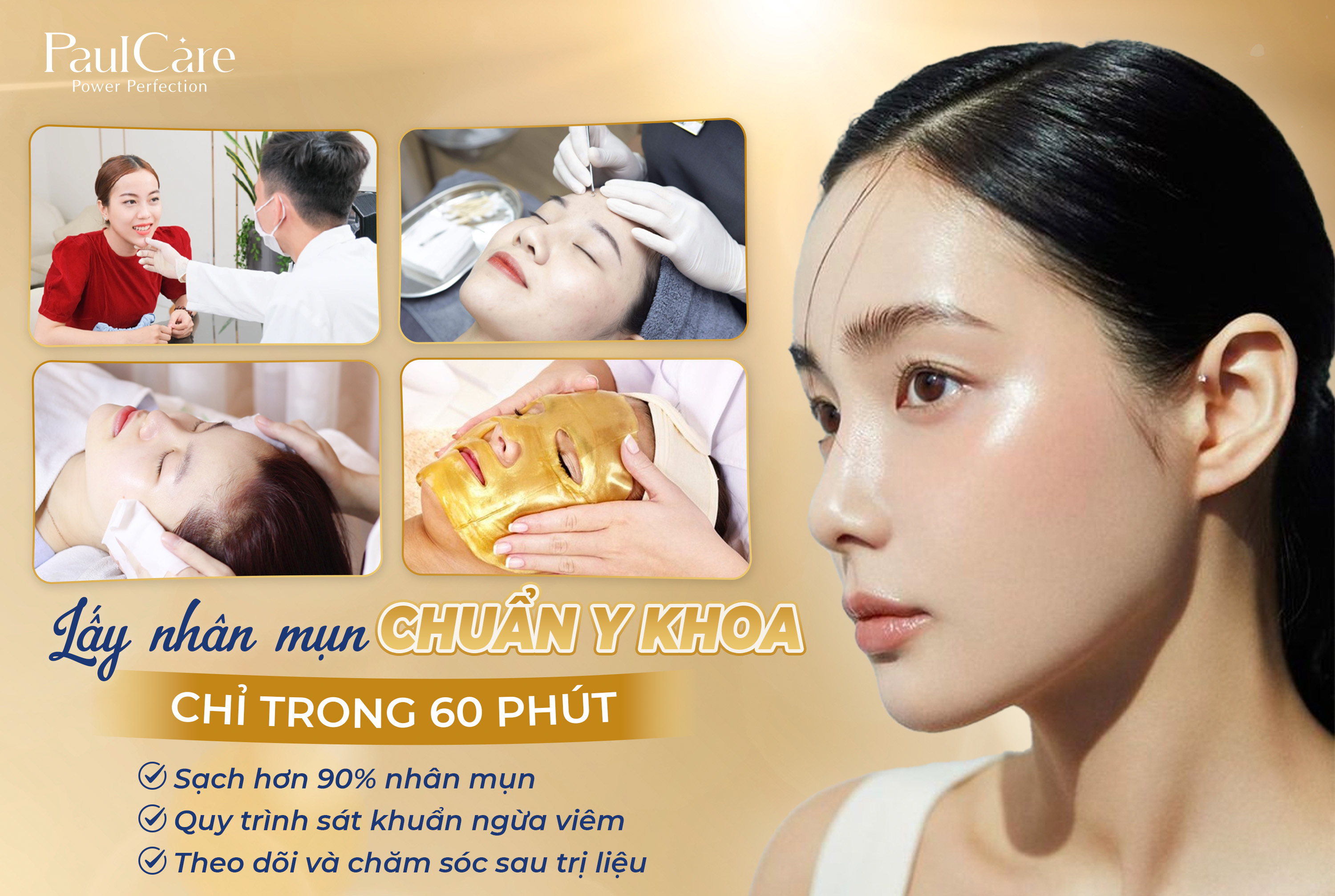 quy_trinh_lay_nhan_mun_paulcare