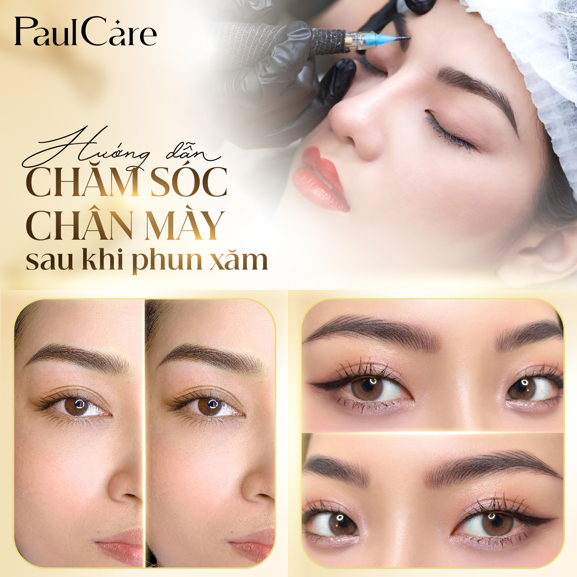 Quy_trinh_phun_may_tham_my_vien_PaulCare_1